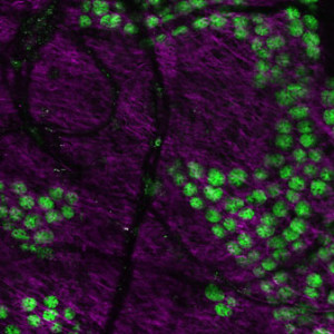 Stem cells in the crypt. Lgr5 cells (green) at the base of intestinal crypts are numerous and proliferative (purple is collagen). Credits: Saskia Ellenbroek/Hubrecht Institute 