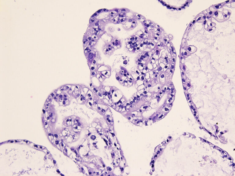 Histological picture of ovarian cancer organoid line
