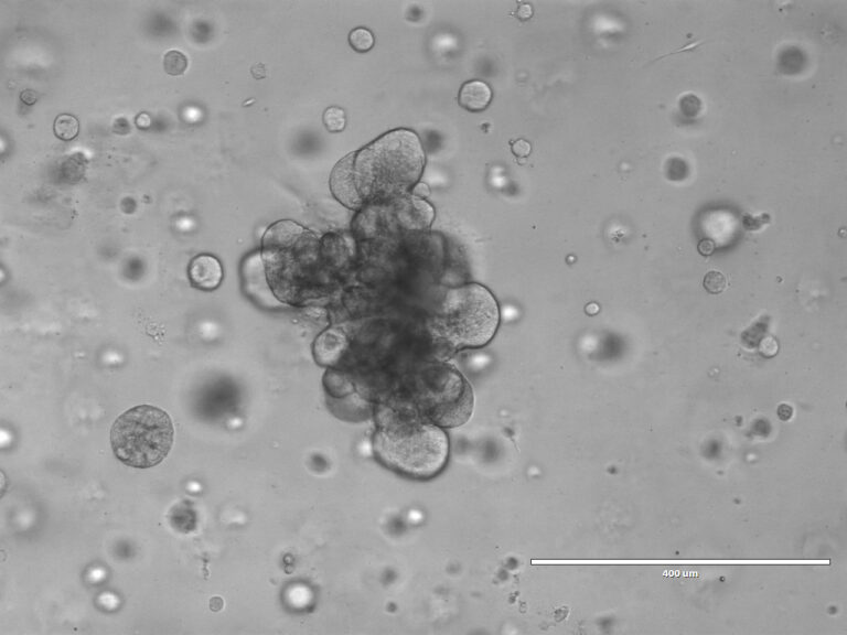 Brightfield microscopy image of snake venom gland organoid culture