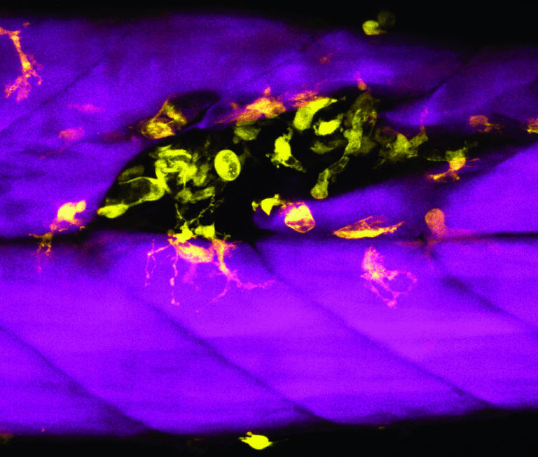 Marcrophage response to muscle injury