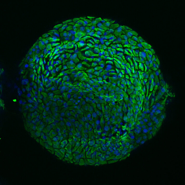 Image of the new organoid model