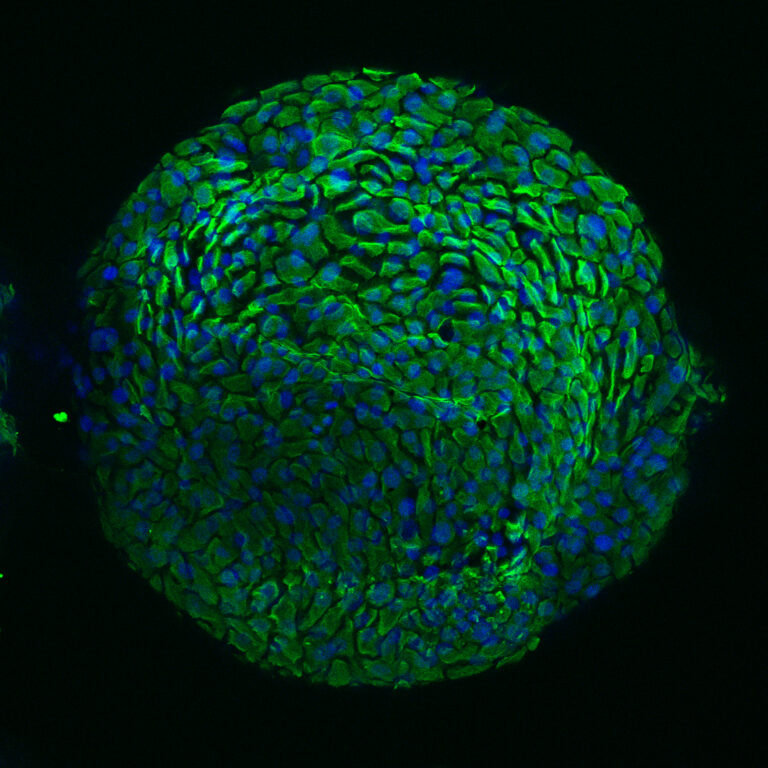 Afbeelding van het nieuwe organoïdemodel