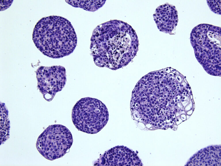 Image of cancerous cervical organoid line