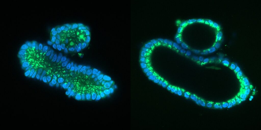 Image of organoids