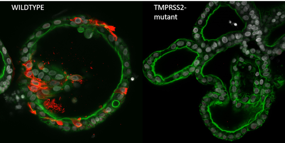 Afbeelding van SARS-CoV-2 geïnfecteerde wildtype organoids en organoids zonder werkzaam TMPRSS2 gen