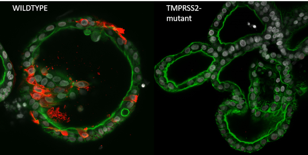 Image of SARS-CoV-2 infected wildtype and TMPRSS2-deficient organoids