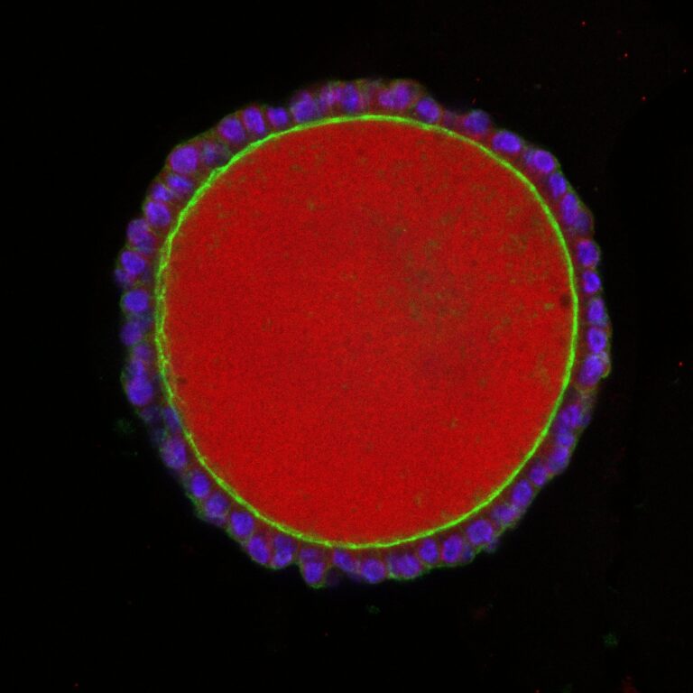 Image of thyroid organoid