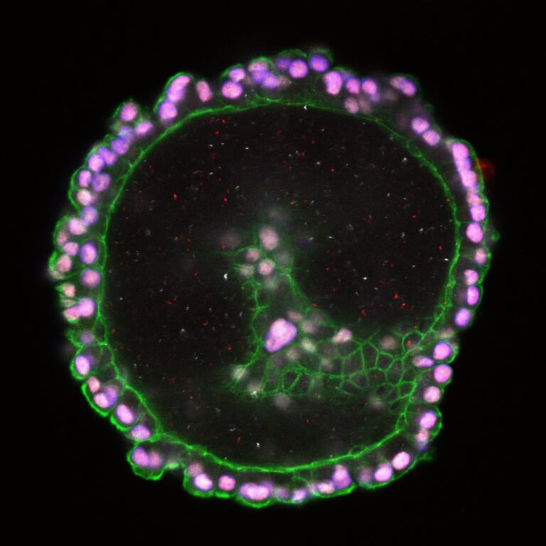 Image of Thyroid organoids