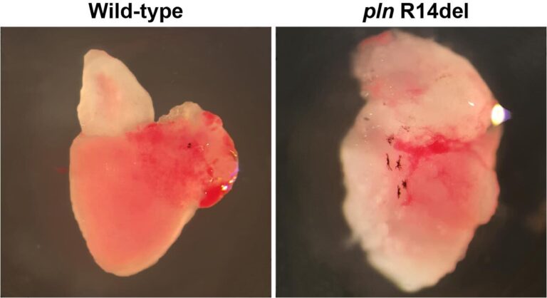 Image showing a healthy wildtype adult zebrafish heart and PLN p.Arg14del adult zebrafish heart with arrhythmogenic cardiomyopathy.
