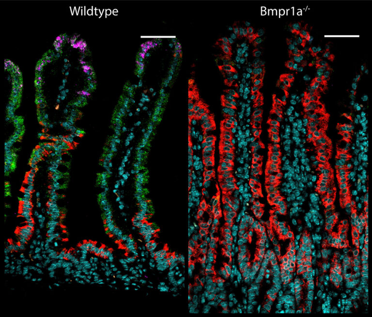 Picture of Zonation in the intestine