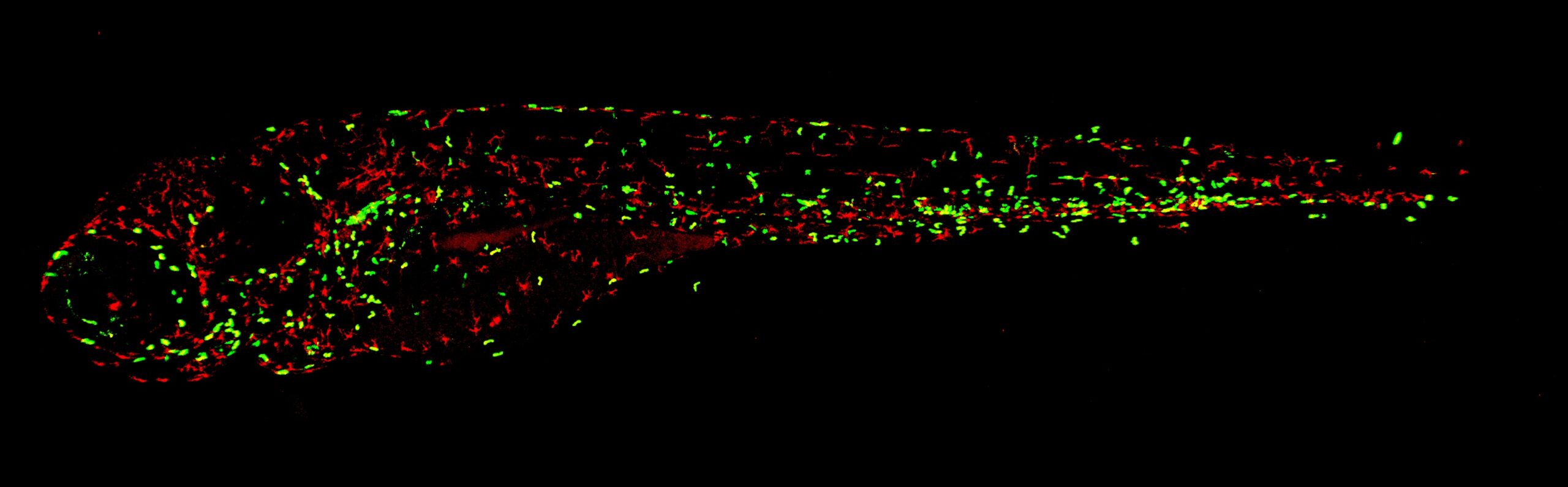 This image shows the macrophages and neutrophils in a zebrafish embryo with a mutation in SHP2. The head of the embryo is on the left, the tail on the right. Similar to the situation in JMML patients, this fish has more macrophages and neutrophils compared to fish without a mutation in SHP2. Image credit: Maja Solman