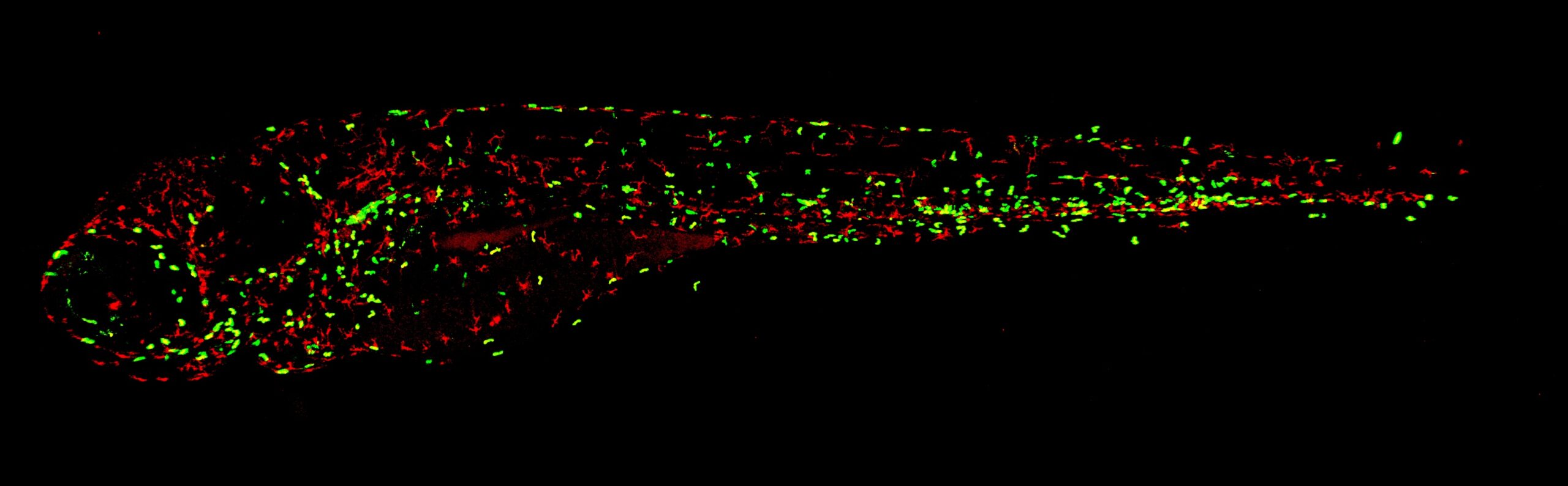 This foto laat de macrofagen en neutrofielen in een zebravissenembryo met een mutatie in SHP2 zien. Dit embryo heeft meer macrofagen en neutrofielen dan een embryo zonder de mutatie in SHP2. Dit is vergelijkbaar met de situatie in JMML patiënten. Image credit: Maja Solman