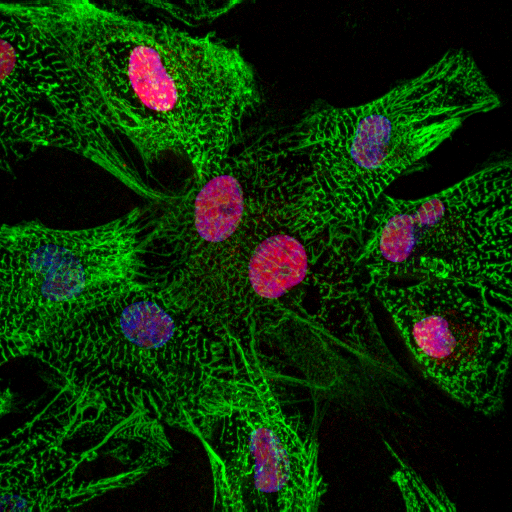 Illustrative image of ZBTB11 in some cells