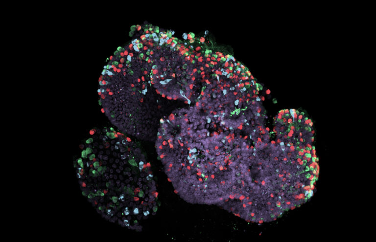 Picture of an human gut organoid