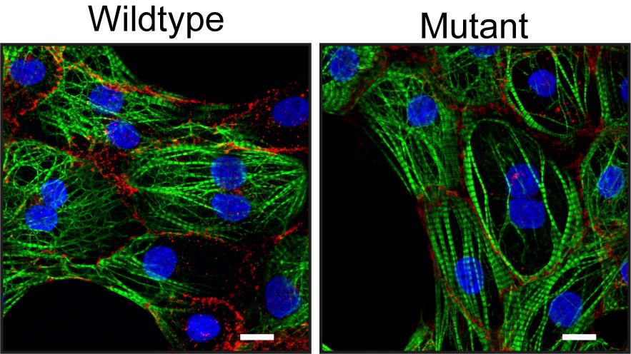 Illustrative image of heart cells with and without the mutation.