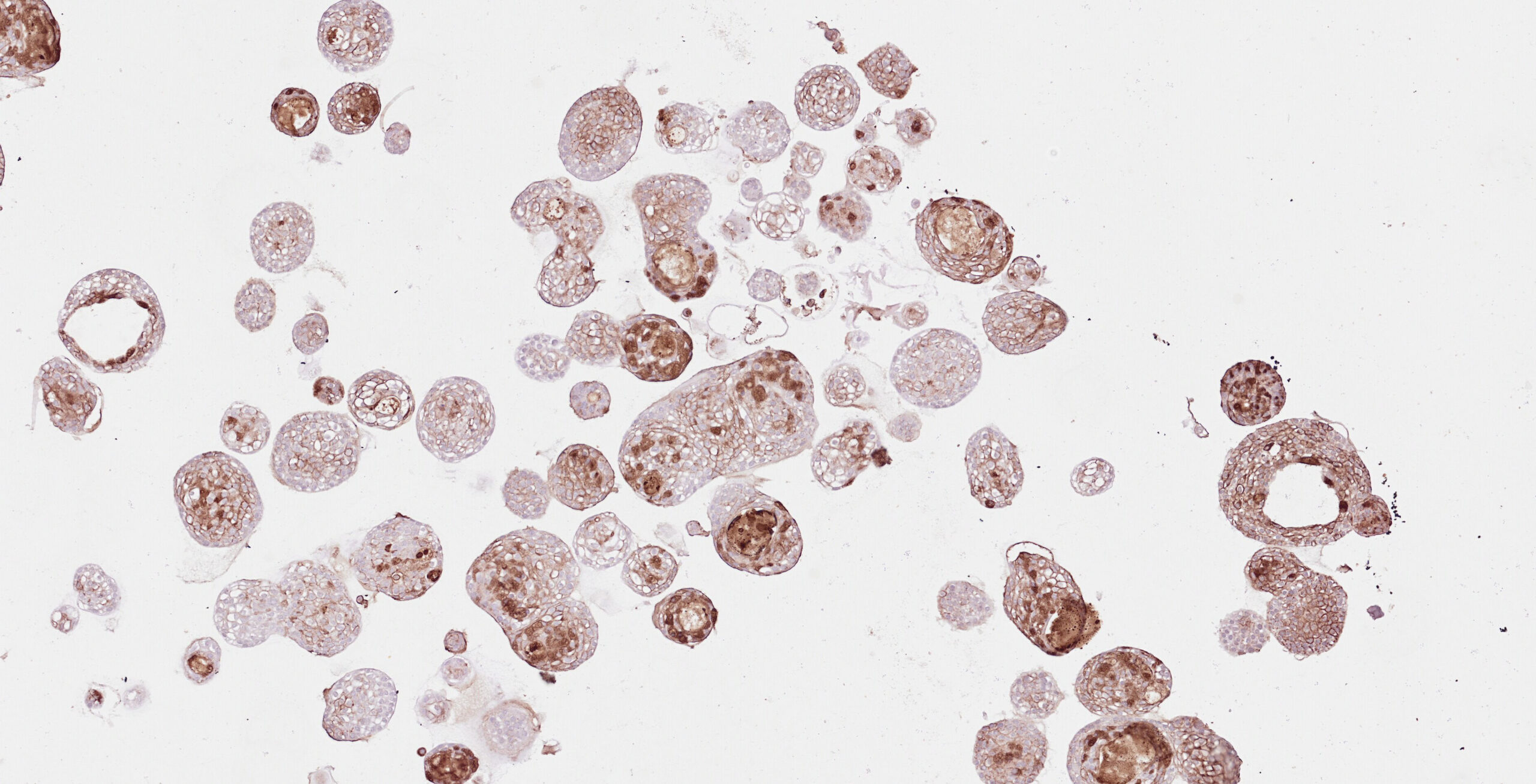 Image of HNC organoids