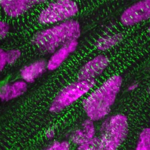 Microscopie afbeelding van ARID1A in hartspiercellen