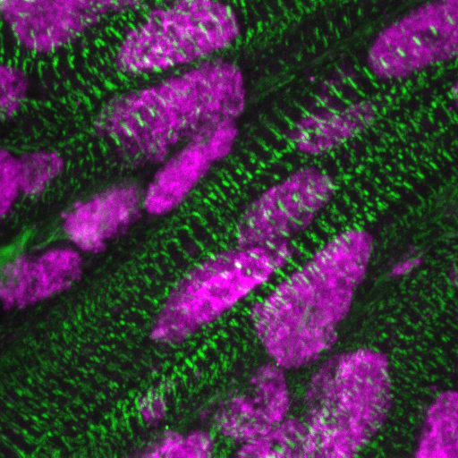 Microscopic image of ARID1A in heart muscle cells