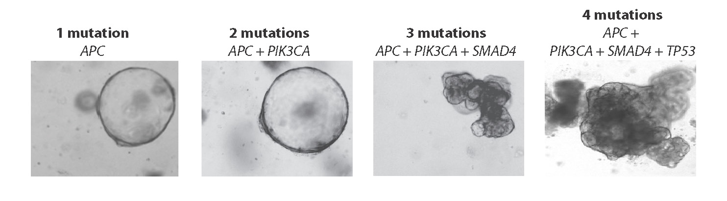 Afbeelding van 4 darm-organoïden met toenemend aantal mutaties