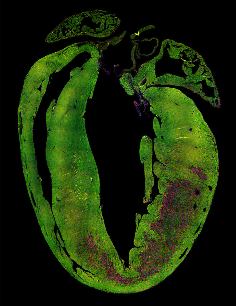 Cross-section of stained heart tissue