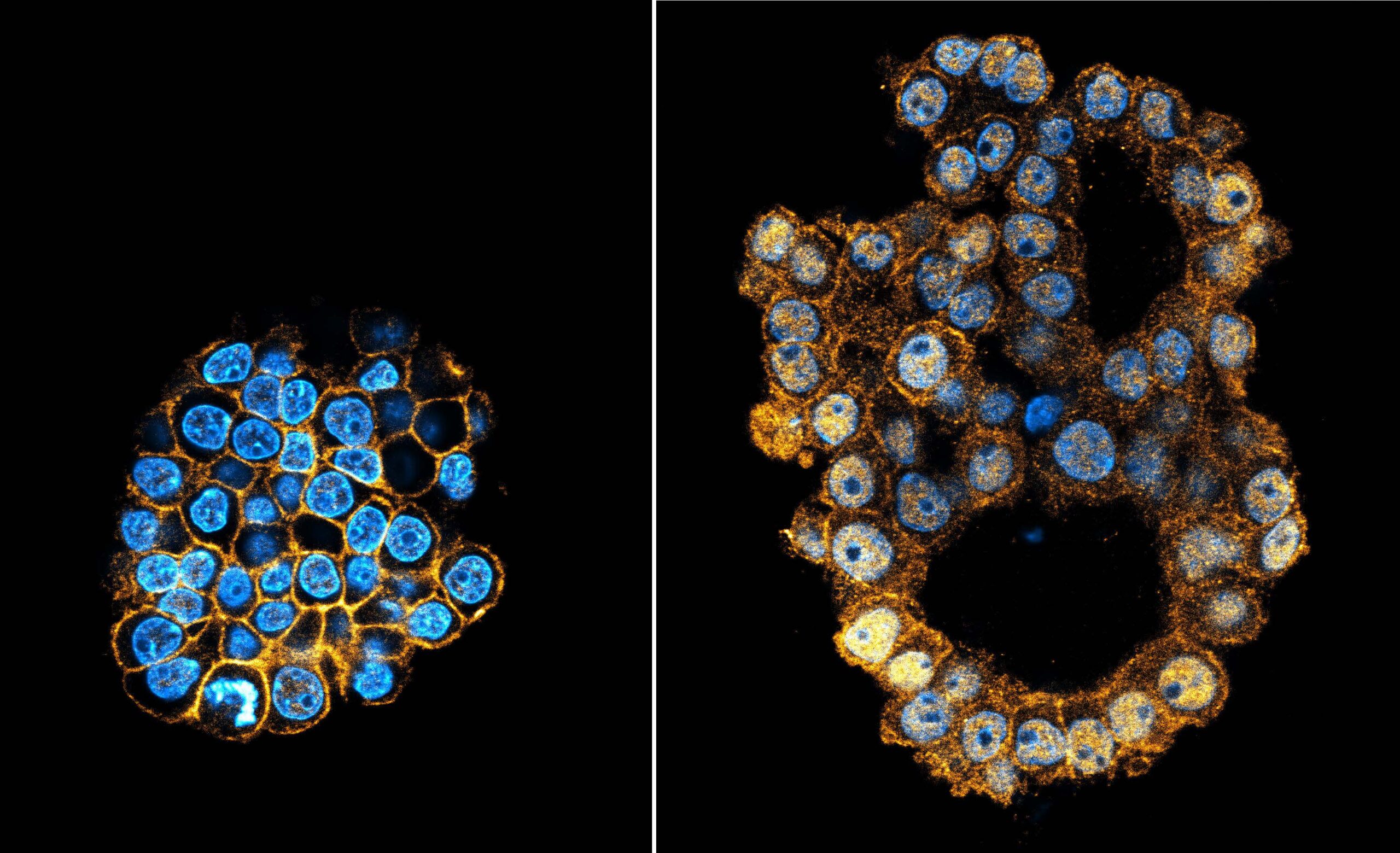 Image of normal and mutant liver organoids