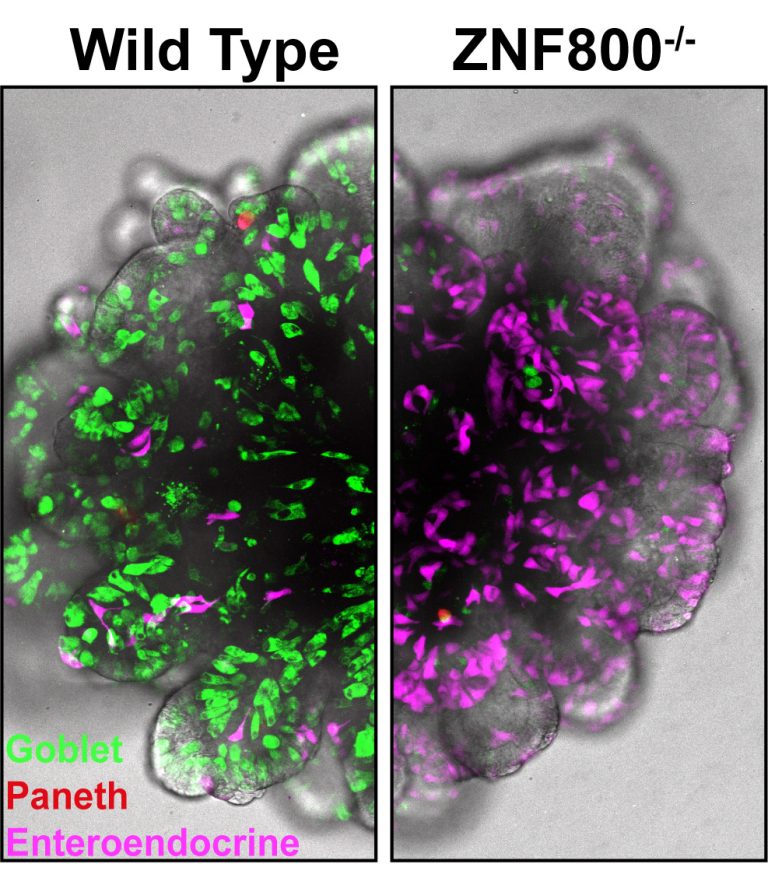 Microscopische afbeelding van menselijke darm-organoïden met en zonder ZNF800.