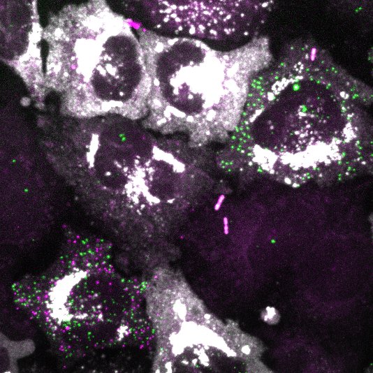 Afbeelding van cellen die de virusinfectie en de verdedigingsreactie van de cel laat zien.