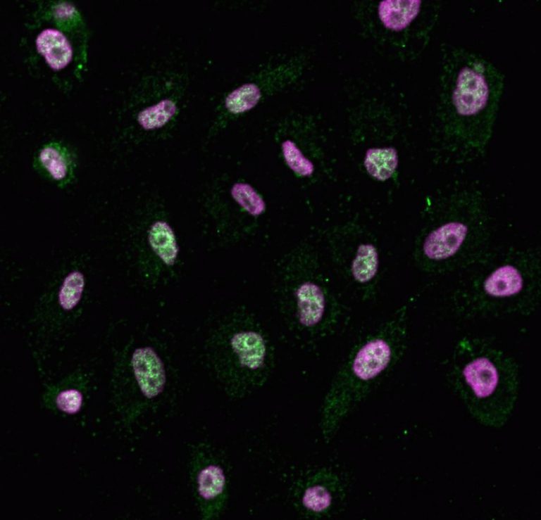 Microscopische foto van menselijke cellen gekleurd voor macroH2A en DNA