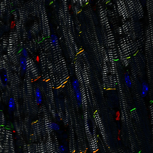 Microscopische foto van hartspiercellen in een muizenhart.