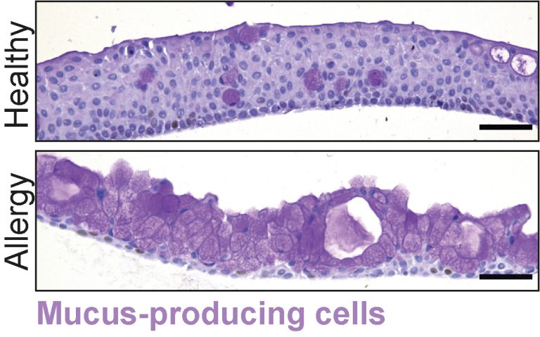 Microscopische afbeelding van gezonde slijm-producerende cellen en slijm-producerende cellen onder allergieachtige omstandigheden.