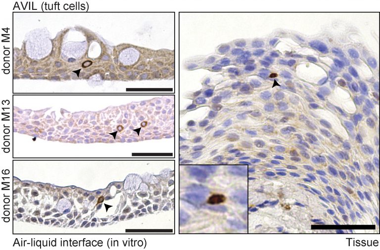 Microscopische afbeelding van Tuft cellen.