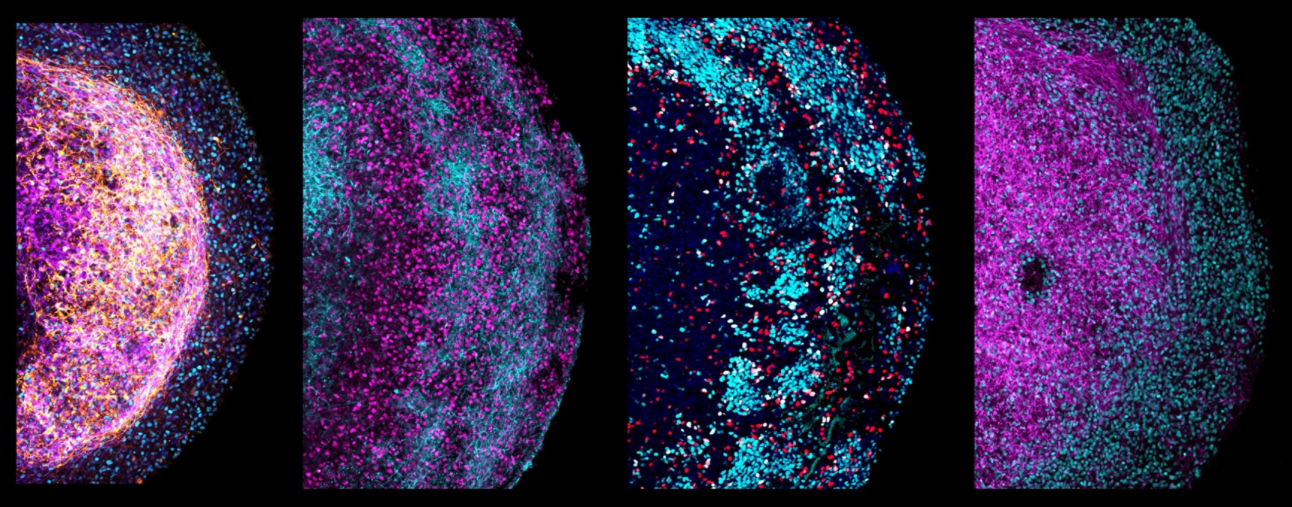 Four zoom-in images of parts of different human fetal brain organoids.