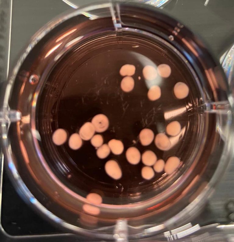 Image of a culture of human fetal brain organoids.