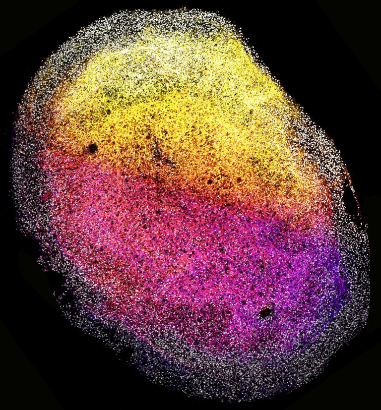 Image of a whole human fetal brain organoid