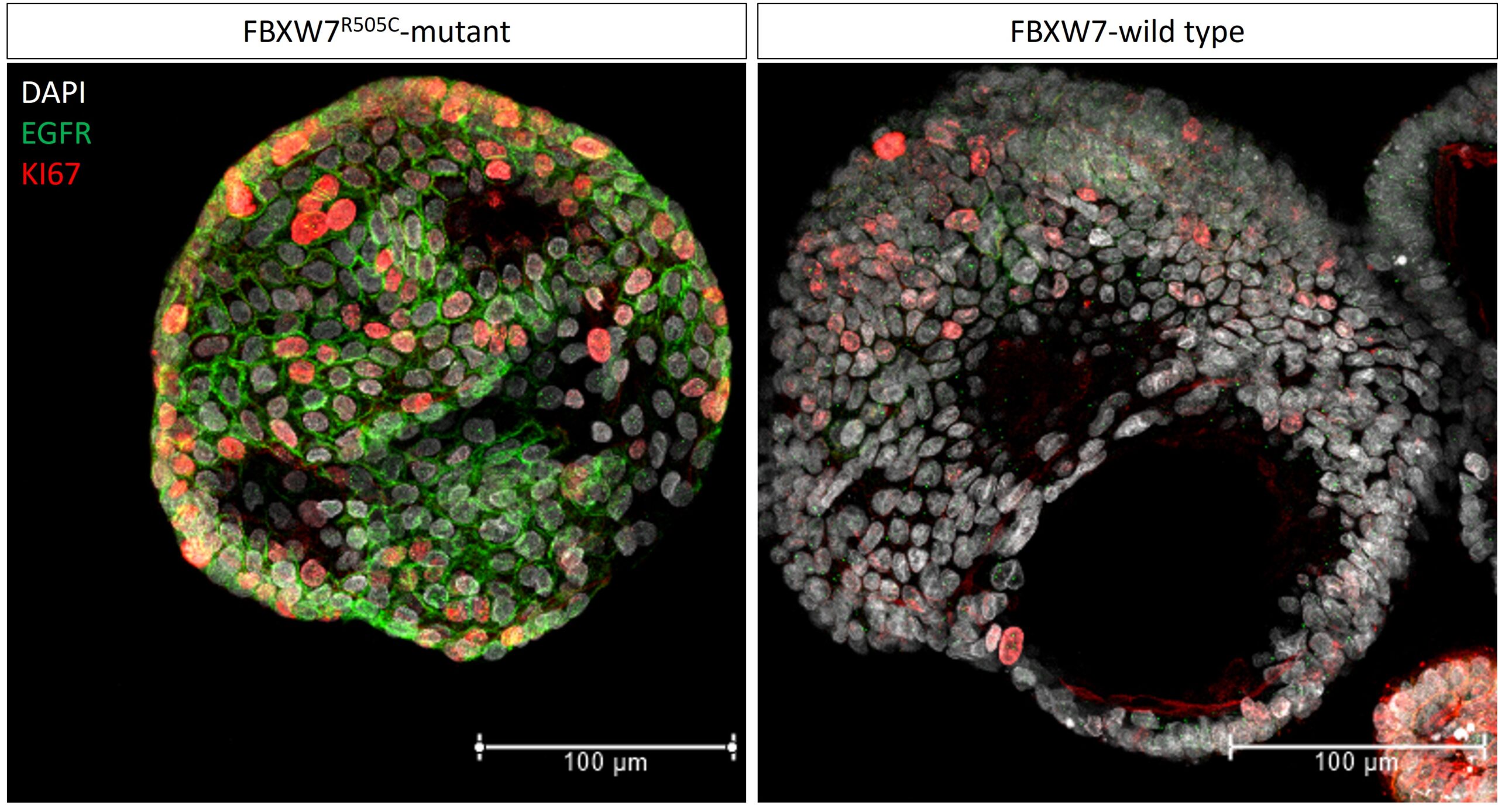 Microscopy images of intestinal organoids showing more EGFR signaling activity in the organoid with the FBXW7 mutation.