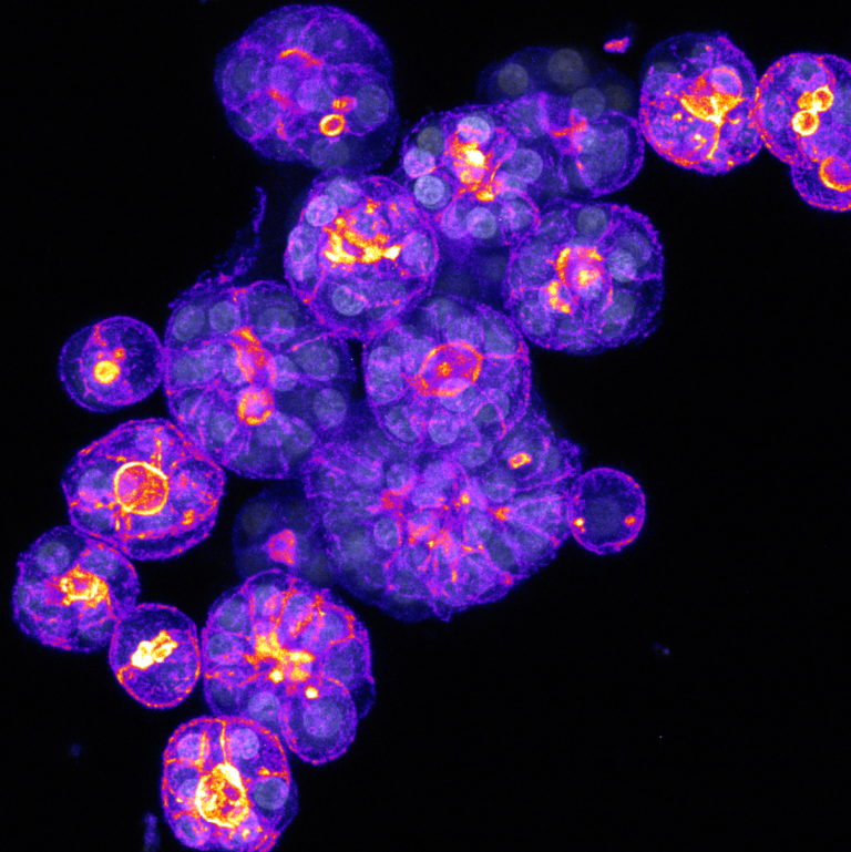 Microscopische foto van menselijke leverorganoïden