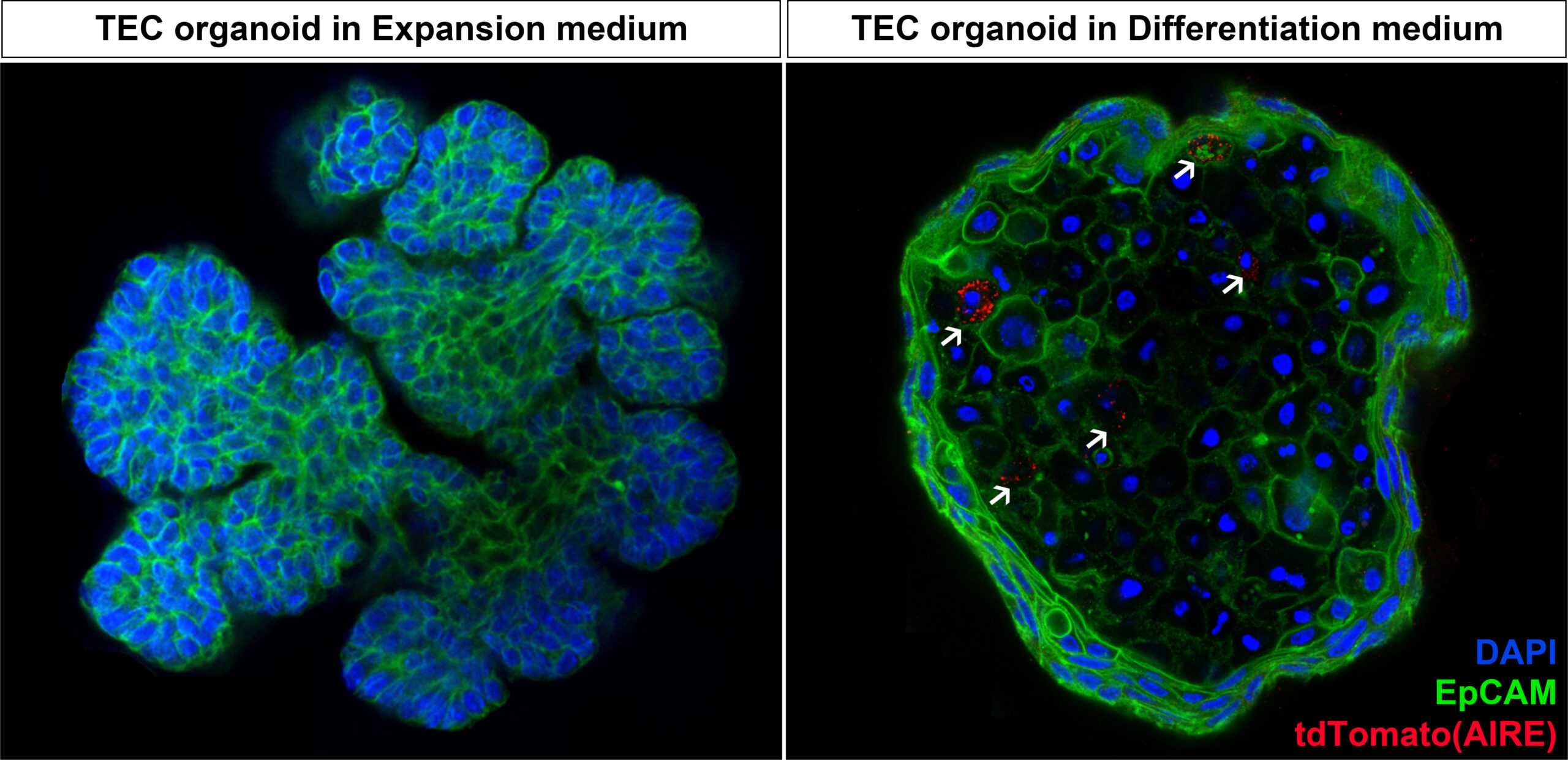 Microscopische foto’s van muizen-thymusepitheelcel-(TEC)-organoïden.