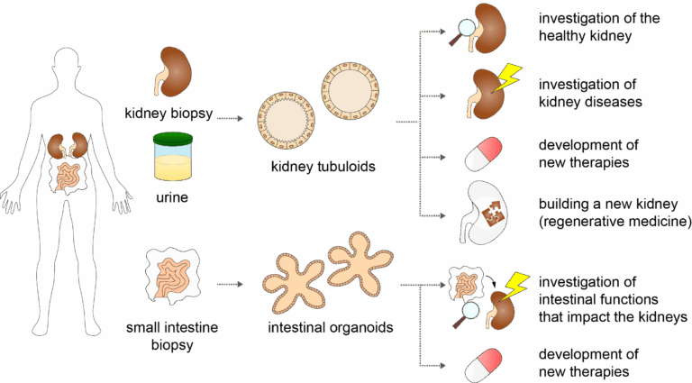 Schematic overview of the variety of topics that can be investigated with kidney tubuloids and intestinal organoids.